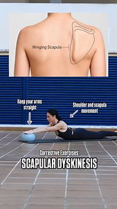 Scapular depression can be applied in scapular dyskinesis correction to reduce excessive upper trapezius dominance and improve lower trapezius engagement, helping restore better scapular positioning and control. However, it should not be the only focus of the program; effective correction also requires serratus anterior activation, proper upward rotation, posterior tilt, and coordinated scapulothoracic movement during arm elevation. Be Healthy!💜 - - #scapulardyskinesis #scapularwinging #scapula