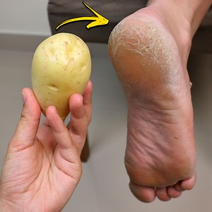 18K views · 537 reactions | Feet & Foot Care...  | My Tips Book | Facebook