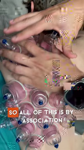 32K views · 176 reactions | #cuppingtherapy aka Myofascial Decompression works wonders! #myofascialdecompression #myofascialrelease #fasciarelease #massagetherapy | Greater Therapeutics | Facebook