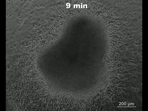 File:Functional-Vascular-Smooth-Muscle-like-Cells-Derived-from-Adult-Mouse-Uterine-Mesothelial-Cells-pone.0055181.s010.ogv - Wikimedia Commons
