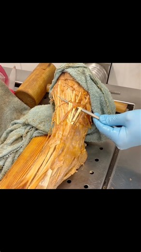 The muscle that moves your toes | Extensor digitorum longus #anatomy #walking #physiotherapist