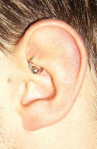 Infected Rook Piercing Symptoms- Treating With Salt and H2Ocean Aftercare Spray