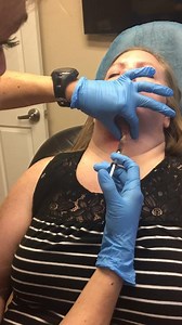 Kybella Injections