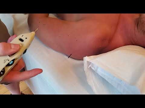 Demonstration of Pointer Plus and Excel to Stimulate Motor Points