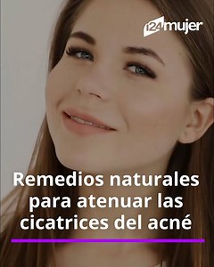 6.8K views · 36 reactions | Remedios caseros para atenuar las cicatrices que deja el acné: no tienes que acudir a químicos agresivos para suavizar las marcas en tu piel ‍♀️ | EsTrending Mujer | Facebook