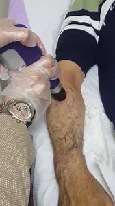 1.3K views · 24 reactions | الموجات التصادمية أو الشوك وييف Shock wave ،،السلاح الجديد لعلاج الشلل التشنجي(.Spasticity) نتائج مذهلة في علاج الشلل التشنجي المصاحب للجلطات الدماغية . نحن صناع الأمل. #المستقبل_في_العلاج_الطبيعي  | First Cure I Centers | Facebook