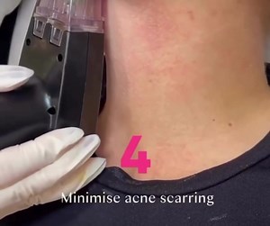 ⚡️ The hype is real. If you haven’t heard of and or learned about...