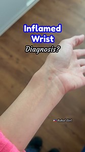 Inflamed Wrist. What’s the doctor’s Diagnosis? #boholgirl #painfulwrist #inflamedwrist | Bohol Girl