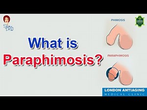 What is Paraphimosis?