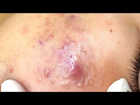 Relax Every Day With Sac Dep Spa #0050