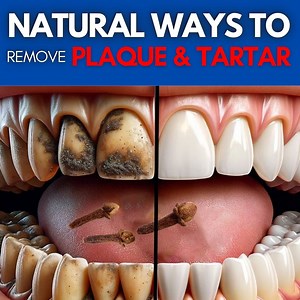 24 reactions | 9 Natural Ways to Remove Plaque & Tartar Buildup! | Go Organique Main | Facebook