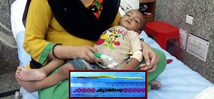 इस मासूम के मुंह और मल से निकलते थे कीड़े, देश में पहली बार हुआ ऐसा इलाज