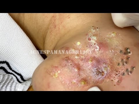 Enjoy Every Day With The Best Video Loan Nguyen Spa Official 2341