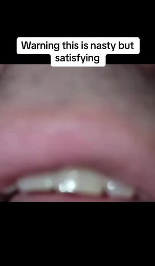 Dr Removal on TikTok