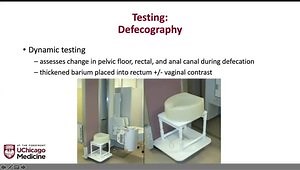 Anorectal Manometry and Interpretation