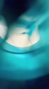 Which are your favourite stunt scooter wheels? 🔥 These teal Striker Lux Spoked are some of ours! 😍 #strikerscooterparts #stuntscooter #scootering #scoot #scooter #scooterparts | Striker scooter parts