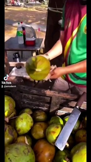 �✨ Dr. Jafari at Amoderm in Irvine is a master of Liquid Facelift & non-surgical skin rejuvenation treatments. From reducing dark circles under eyes & non-surgical nose job to lip & chin augmentation & more, let the best cosmetic doctor in the OC do your treatments! Schedule your complimentary consultation today to learn about all non-surgical rejuvenation & cosmetic treatments! ✨ Please note: Some bruising and swelling is possible following all cosmetic injections; Individual results may vary _