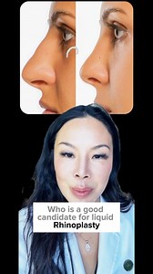 The major benefits of non surgical liquid rhinoplasty #beauty #face #skin #skinhealth #skintreatment #dermalfiller #filler #dermalfillers #fillers #rhinoplasty | Parfaire Medical Aesthetics | Facebook