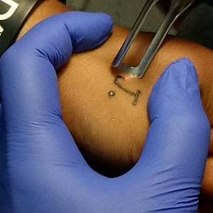 11K views · 19 shares | Laser Tattoo Removal | Dynamic Tattoos-9769735982 | Facebook