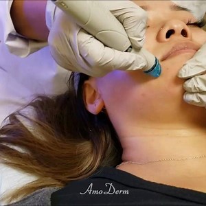  Ready to take your skin to the next level? Try a HydraFacial at...