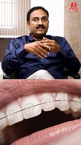 12K views · 75 reactions | Metal Braces-க்கும், Ceramic braces-க்கும் இதுதான் வித்தியாசம்! #Orthodontics #Braces #Invisalign #DentalCare #SmileMakeover #Orthodontist #DentalHealth #TeethStraightening #OralHealth #OrthodonticTreatment #dentaltips #OrthoCare #Dentistry #Aligners #Kumudam | Kumudam - குமுதம் | Facebook