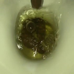 My girlfriend's poop 12