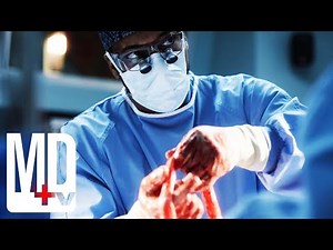 Doctors Take a Chance to find a Tumour with an Exploratory Surgery | MD TV | New Amsterdam | MD TV