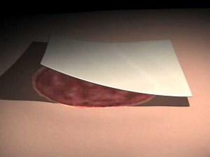 Decellularized Dermis HAsystems Israel