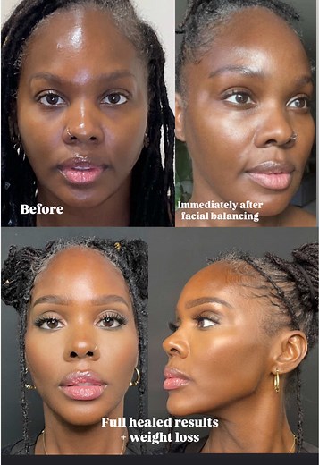 Anti-Aging Treatments at Peel Haus Aesthetics