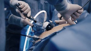 chirurgiens Professionnels dans la salle d'opération. : vidéo de stock (100 % libre de droit) 3472184731 | Shutterstock