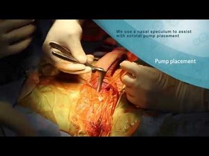 Smallest Scrotal Titan Penile Implant Incision  • Video • MEDtube.net