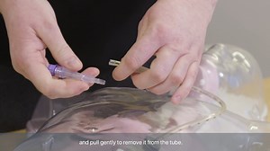 Replacing the Y end on a Corflo PEG tube