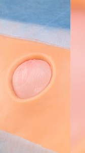 15K views · 65 reactions | Surgical Secrets Doctors Don’t Usually Share | 5-Minute Crafts UK | Facebook