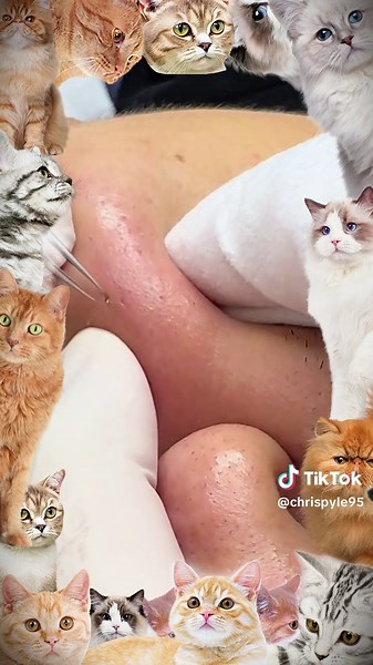 Chris Pyle (@chrispyle95) - Effective Skin Cleansing Techniques for Acne Relief