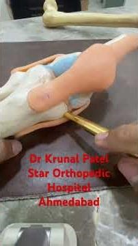 Importance of Medial Collateral ligament in Knee#MCL INJURY#knee stability#Mcl recovery#sportsinjury