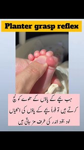 266K views · 2K reactions | Contact for Appointment 0300-4196220 056-3540787 #PlantarGraspReflex #BabyReflexes #InfantHealth #PediatricCare #NewbornCare #BabyFootReflex #ChildDevelopment #ReflexTest #BabyHealthTips #MotherCare #BabyGrowth #HealthyBaby #Paeds #PakistaniMoms #BabyEducation | Zohra Hospital | Facebook