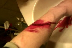 Cutting His Wrists