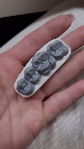 #teethwaxing #Dentures #SmileConfidently #DenturesBar #ToothTransformation #DentalCare #CustomDentures #OralHealth #SmileMakeover #DentureLife #HealthySmile #DentistApproved #DentureSolutions #ComfortableDentures #ConfidenceInEverySmile #DentureDesign | Greenlab_