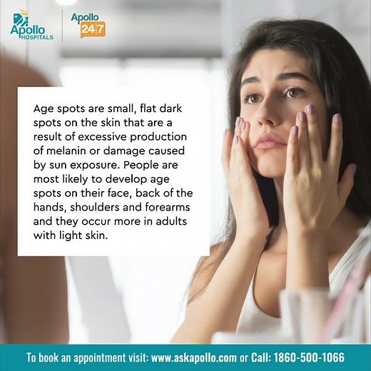 How do people get Age Spots? What are the symptoms of age spots? | Apollo Hospitals