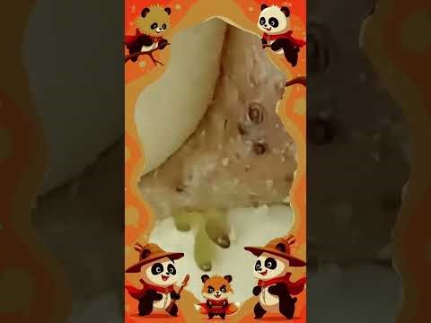 Blackheads Removal #349 | Acne Treatment and Very Satisfying Satisfying Pimple pop #blackheads