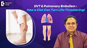 Deep Vein Thrombosis (DVT) is a serious condition where a blood clot forms in the deep veins, usually in the legs. It often occurs after surgeries, immobility, or in conditions like cancer or varicose veins. If untreated, DVT can lead to pulmonary embolism, which can be fatal. Early diagnosis through Doppler and treatment with anticoagulants is key to DVT prevention and management. #DoctorsCircle #DVT #DeepVeinThrombosis #PulmonaryEmbolism | Doctors' Circle