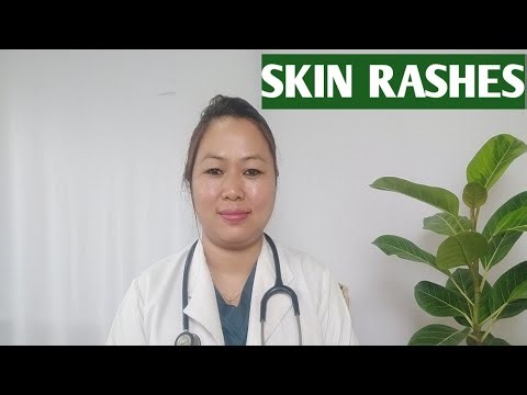 SKIN RASHES😱 ??!!It's Different types,Causes ,symptoms & Awareness✅🍀😇
