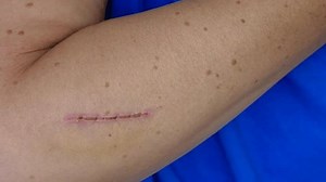 Traiter une coupure profonde de la : vidéo de stock (100 % libre de droit) 3530090033 | Shutterstock