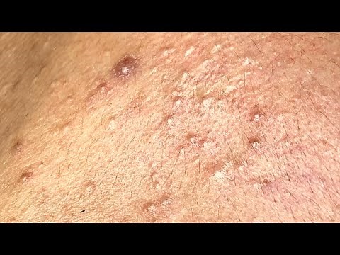 Relax Every Day With Sac Dep Spa #0252