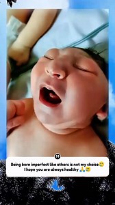 Microcephaly is a lifelong condition, and there is no cure, but the symptoms resulting from brain damage can be treated, and some of the disorders that cause microcephaly can be treated. Microcephaly is a rare neurological disorder in which a baby's head circumference is much smaller than normal for their age. #Prayer #Microcephaly #Congenitaldefects #Reality | Sian Nainggolan