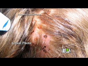 Could a Parasite Be Living Inside You?