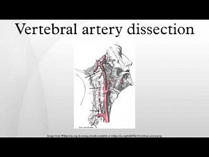Vertebral artery dissection