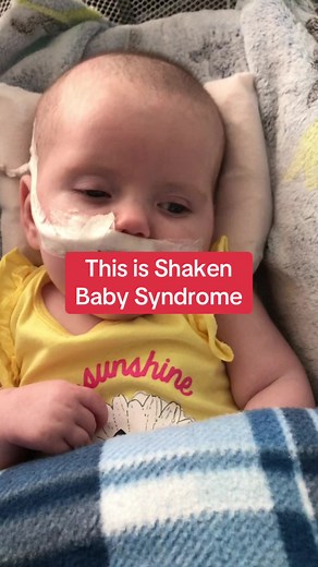 Understanding Shaken Baby Syndrome: A Family's Story