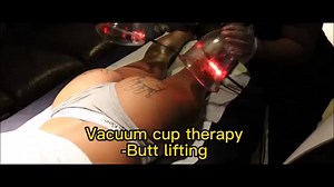 2024 Popular Bbl Breast Butt Lifting Enlargement Xxl Cup Device Butt Lift Vacuum Therapy Buttocks Machine