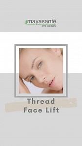 With thread face lift treatment, you can achieve: 📌 Firmer and lifted skin, 📌 A natural facial contour, 📌 Immediate and noticeable results! | Özel Mayasante İzmir Polikliniği